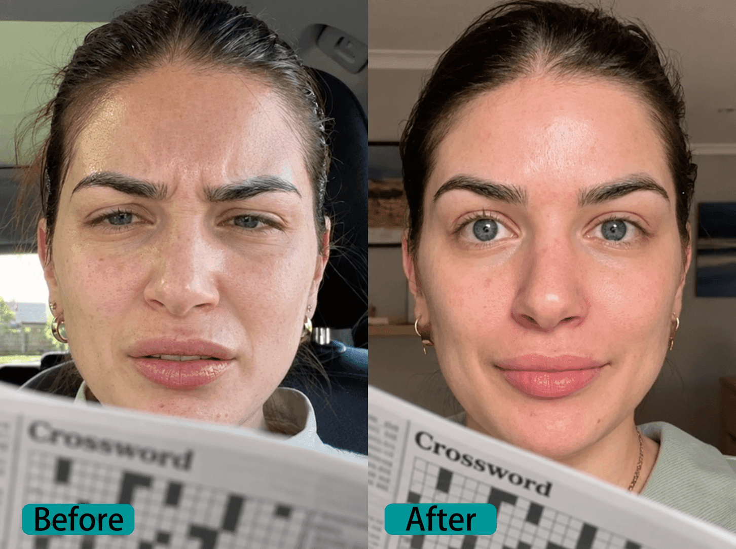 Before image for Patricia, 42