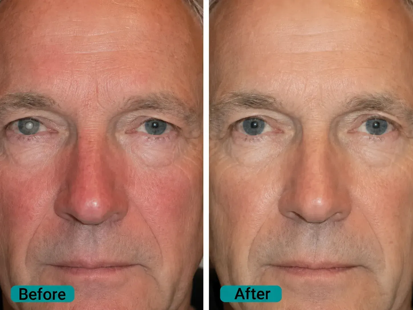 Before image for Ellen, 63