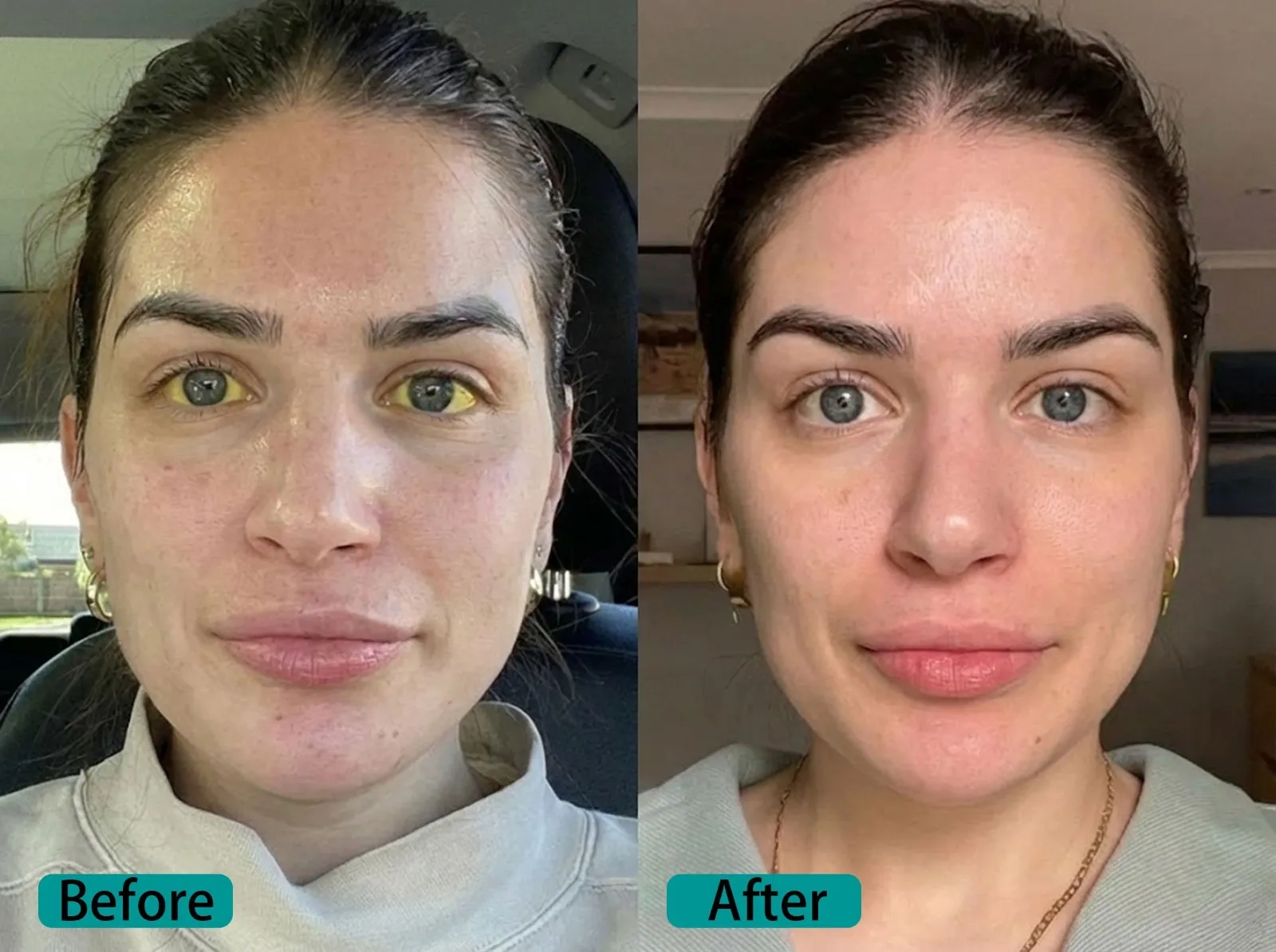 Before image for Patricia L., 41